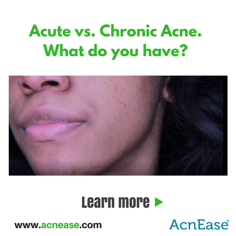 Acute vs Chronic Acne: How to Identify in Order to Treat