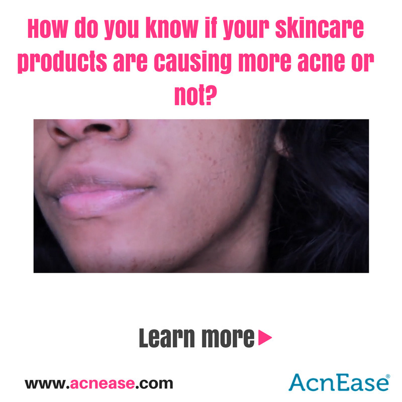 Are Your Skincare Products Causing More Acne?