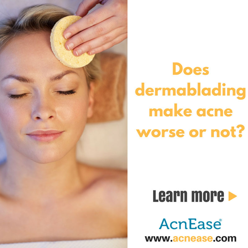 Does Dermablading help Acne-Prone Skin?