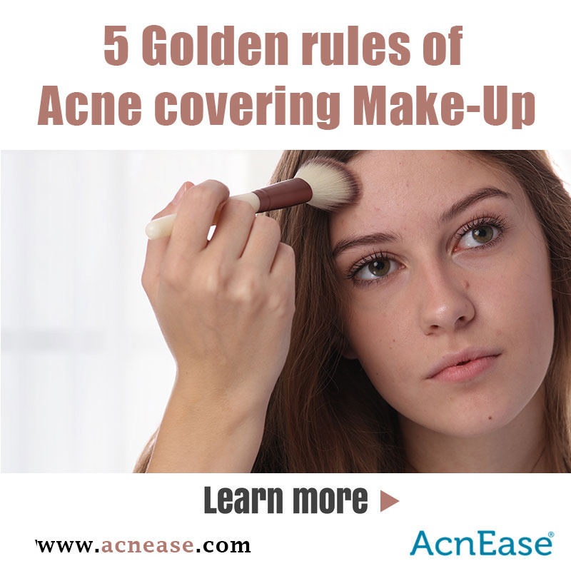5 Golden rules of Acne covering Make-Up