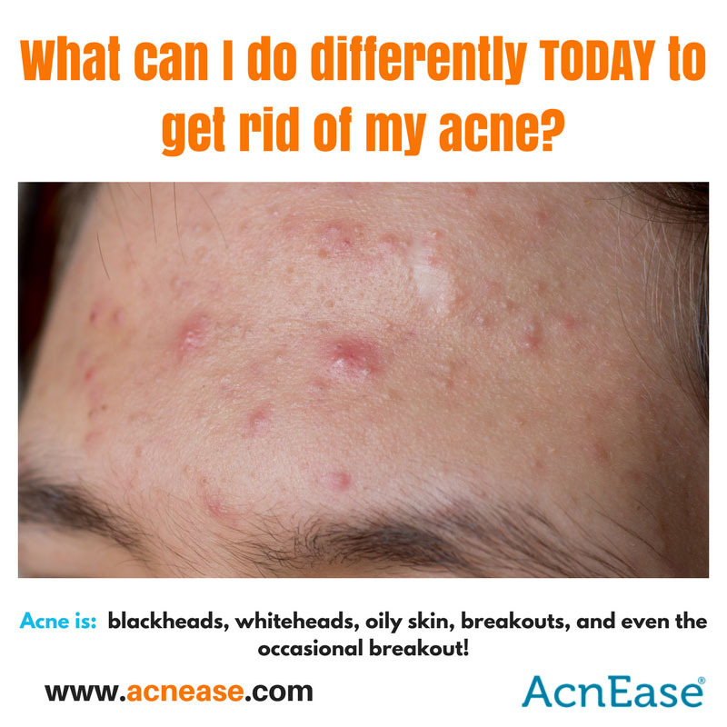 5 Ways to Make a Huge Difference in Clearing Acne TODAY!