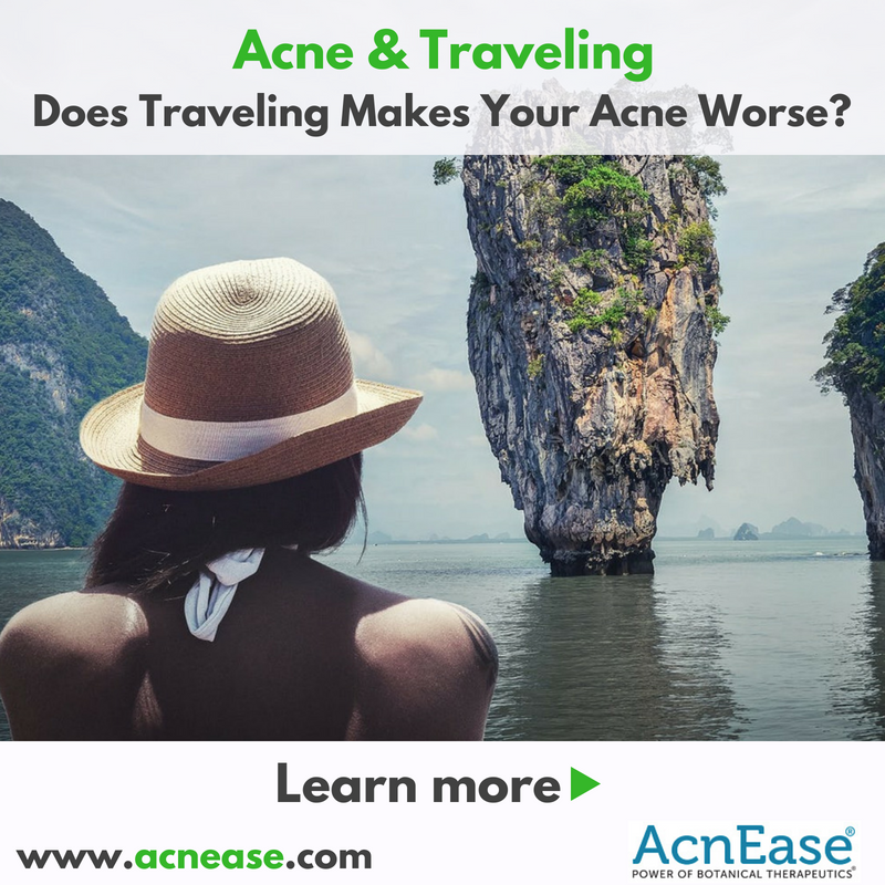 Acne and Traveling: Does Traveling Makes Your Acne Worse?