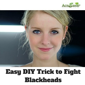 An Easy DIY Trick to Fight Blackheads