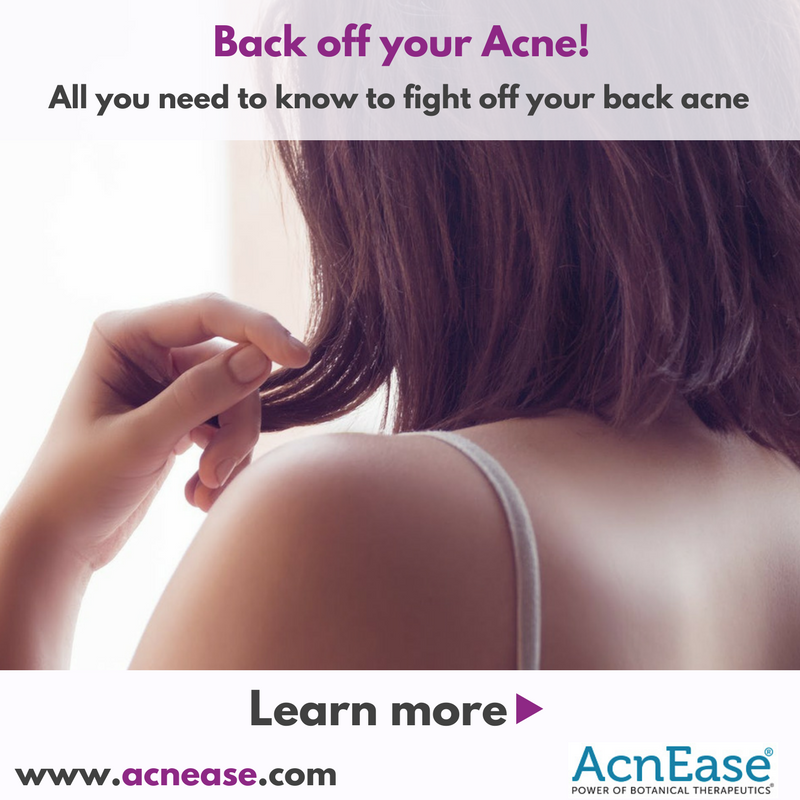 Back off your Acne!