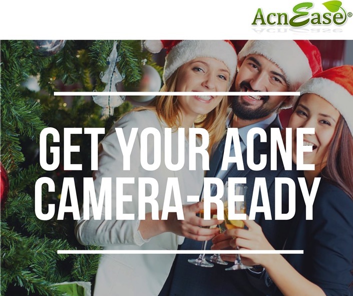Get Camera-Ready with Tips to Conceal Any Type of Acne