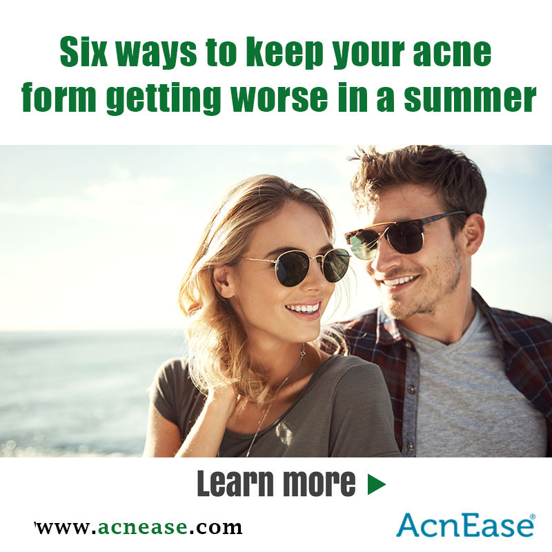 Six ways to keep your acne form getting worse in a summer