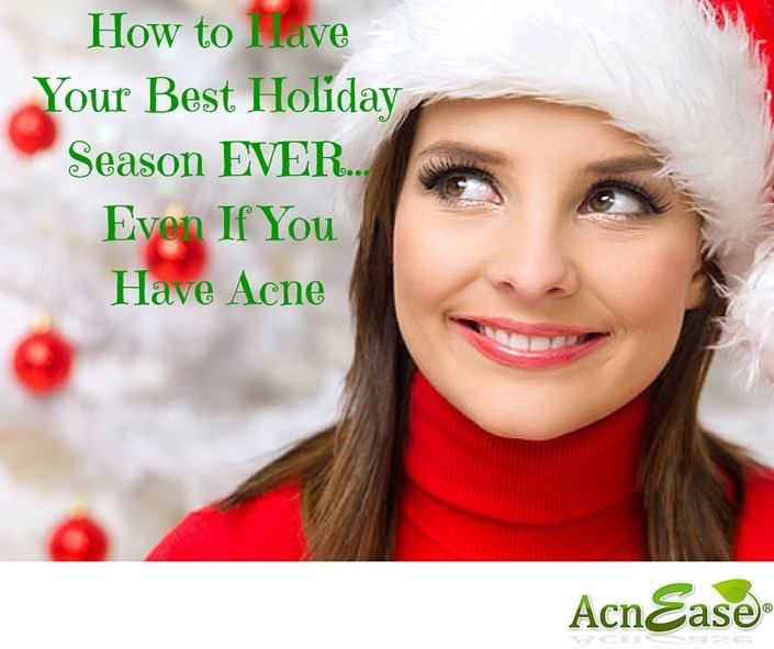 How to Have the Best Holiday Season EVER – Even If You Have Acne