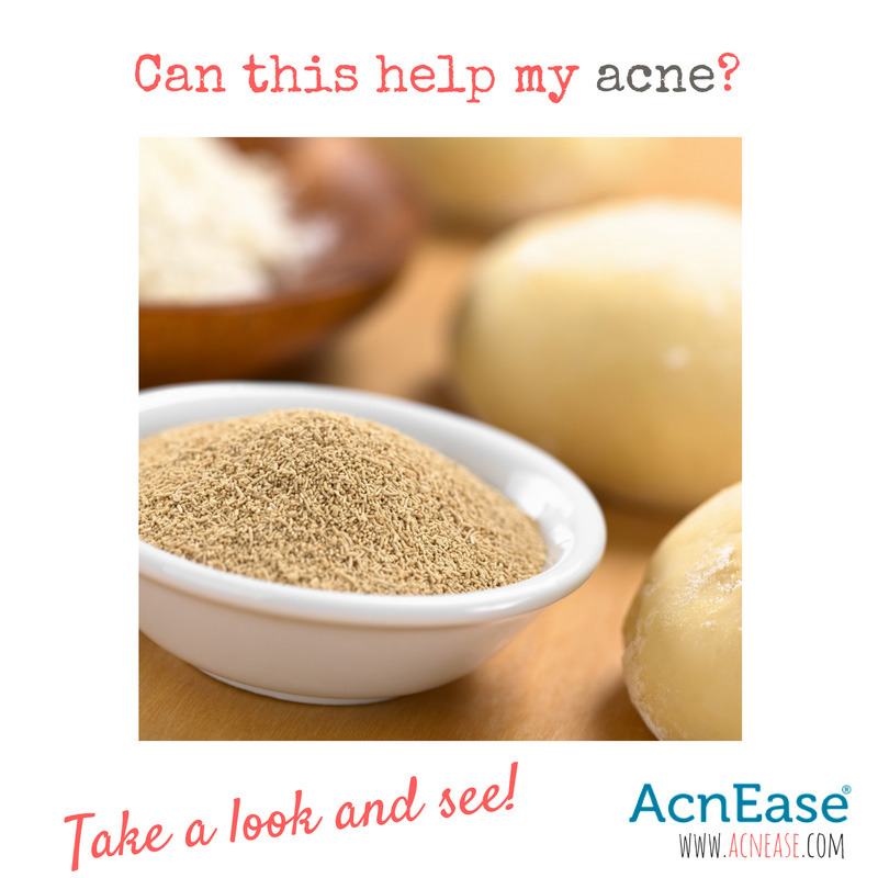 The Many Ways To Use Brewer's Yeast To Help Fighting Acne