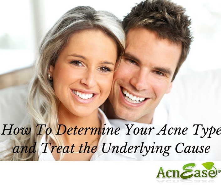 What’s Your Acne Type? Learn the Different Symptoms and Take Charge of YOUR Treatment! 