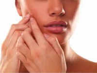 The Truth About Acne Scars