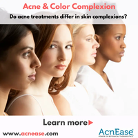 Is acne treatment different for different color complexion?