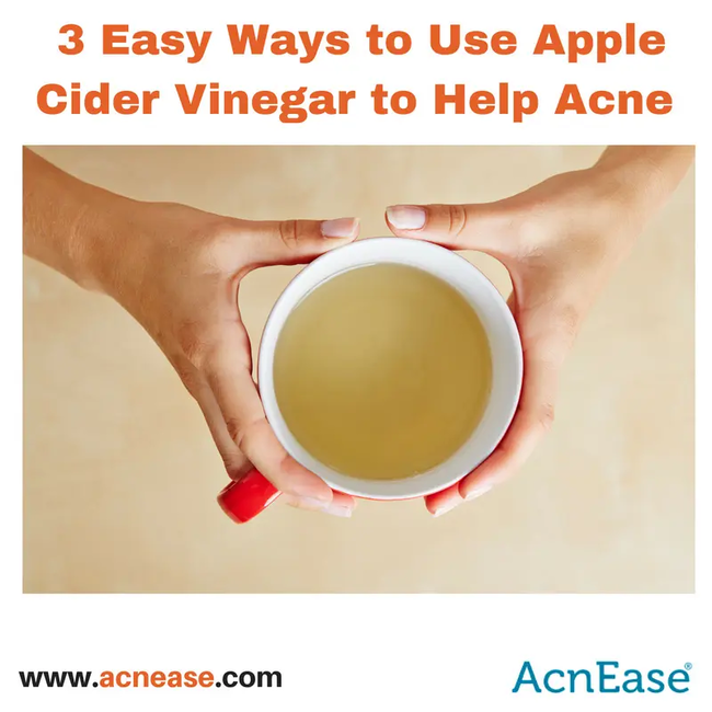 3 Easy Ways To Use Apple Cider Vinegar To Help Your Acne