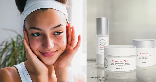 What Can I Do About My Acne Scars?